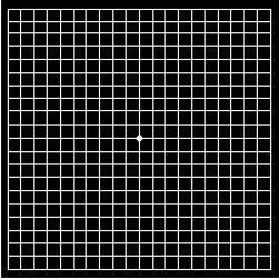 Eye Grid Chart